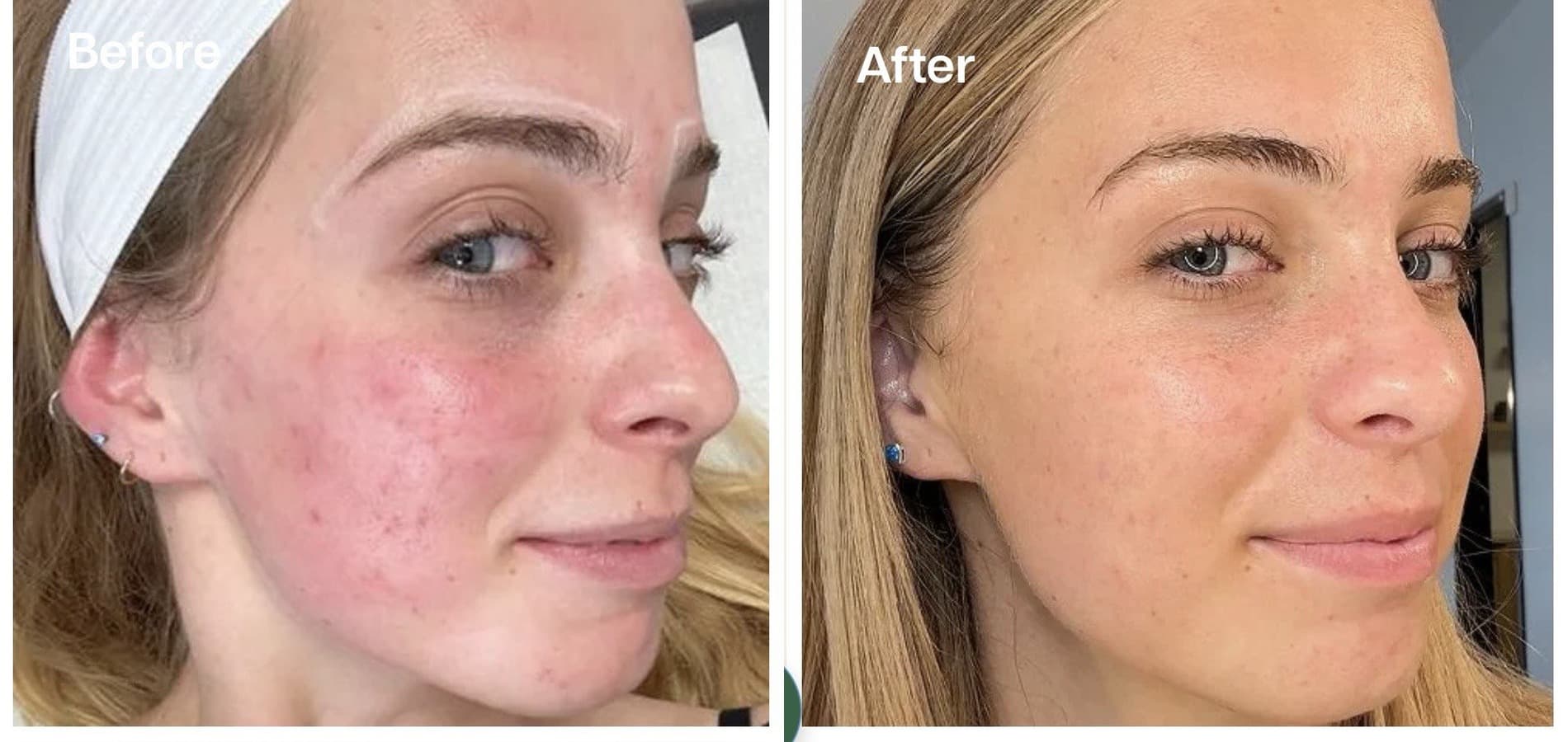 Client before and after