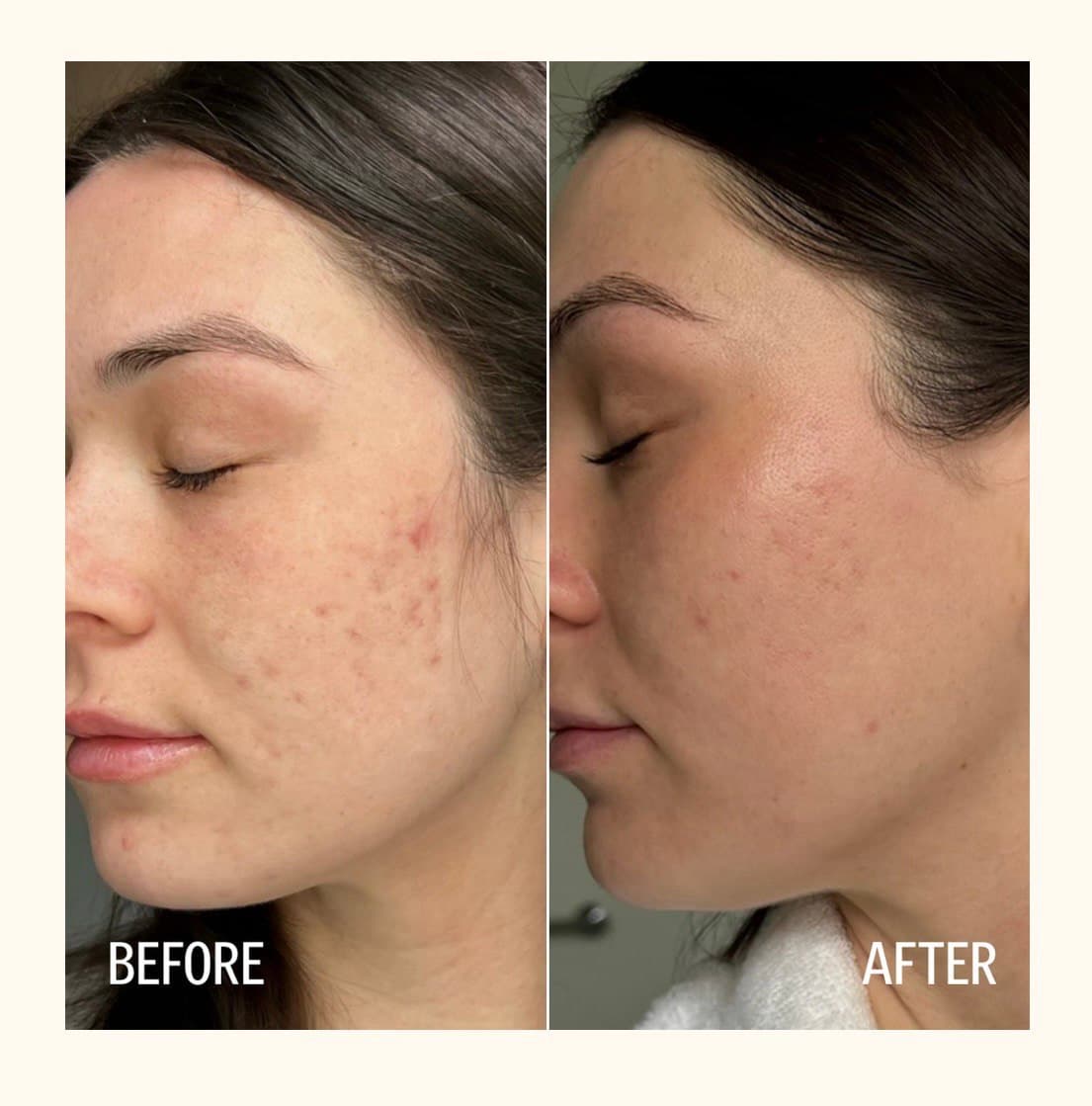 Client before and after